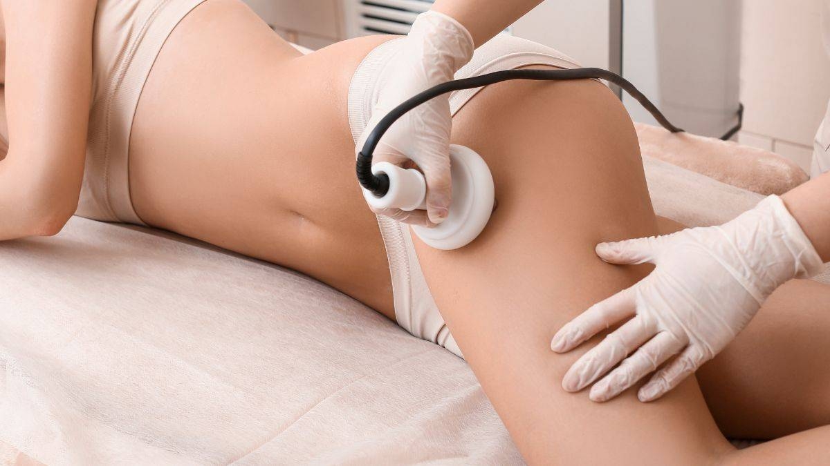 La guía definitiva de la celulitis: estas son las mejores opciones para  combatirla