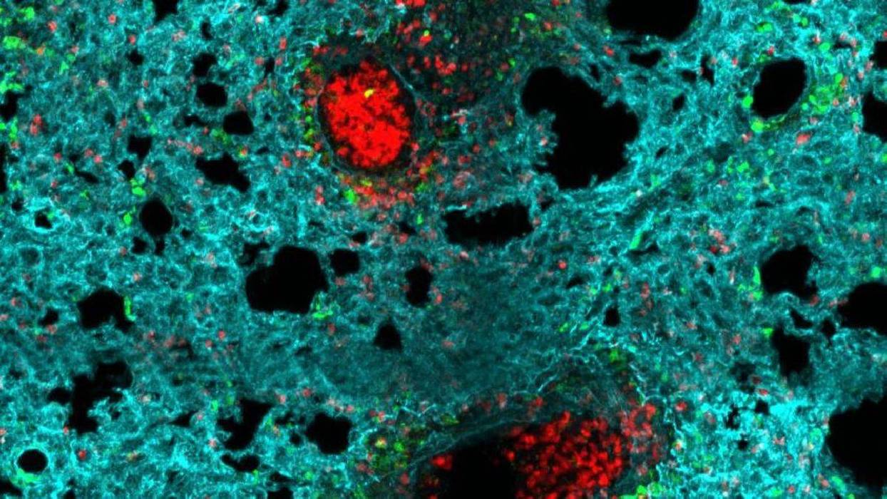 Publican 'Neumap', el primer atlas que revela cómo funcionan las células clave del sistema inmunitario