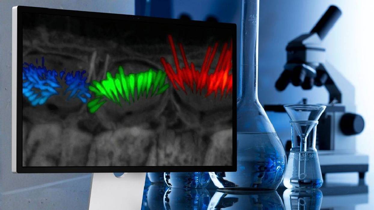Una herramienta de IA logra imágenes en 3D inéditas de células clave para investigar la pérdida auditiva 