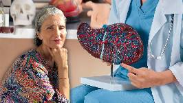 'Un hígado feliz': "La salud hepática es un reflejo de la salud metabólica"