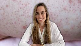 Esos 'granitos' en brazos no son acné ni alergia: las claves de una dermatóloga para suavizar la queratosis pilaris