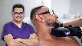 Láser de barba: "Es fundamental acordar exactamente qué zonas se van a tratar"