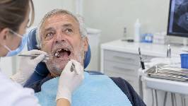 La salud bucodental mundial, lejos de la meta de 2030: el cáncer oral crece un 18% y el edentulismo un 11%