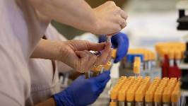 La Xunta de Galicia amplía el cribado poblacional del cáncer de cérvix a los 30 años