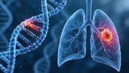 Una mutación del gen EGFR podría cambiar la detección precoz del cáncer de pulmón
